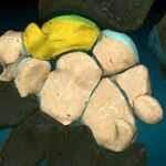 ¿Qué son los huesos cortos?