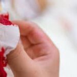 La hemoptisis masiva es una urgencia médica