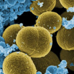 Portadores asintomáticos de Staphylococcus aureus
