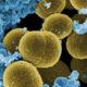 Portadores asintomáticos de Staphylococcus aureus