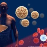 Pronóstico de la infección por virus de la hepatitis C crónica