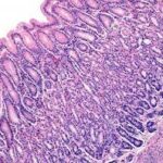 Defensa de la mucosa gástrica