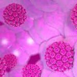 ¿Por qué vacunar contra el virus del papiloma humano?