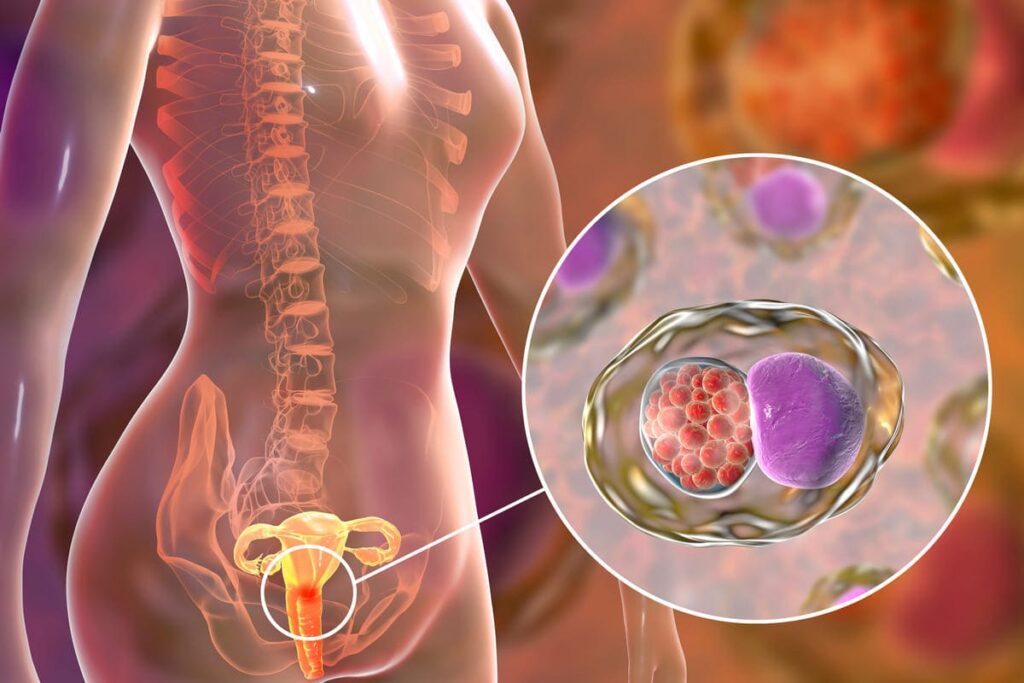 Prevención contra la infección por clamidia