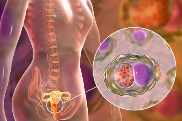 Prevención contra la infección por clamidia