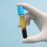 Detección sistemática de los niveles de lípidos en sangre