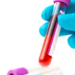 Detención de glucosa para conocer el riesgo cardiovascular