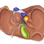 Anatomía de la cara viceral del hígado
