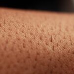 Variaciones de la piel en el cuerpo