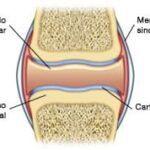 ¿Cuáles son las articulaciones sinoviales o diartrosis?