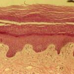¿Qué es la epidermis?