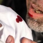 ¿Qué es la hemoptisis masiva?