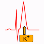 Causas de hiperpotasemia