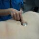 Exploración en pacientes con sospecha de aneurisma aórtico