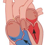 Precarga y poscarga cardiaca