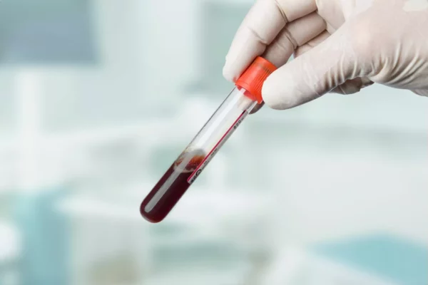 Cantidad normal de hemoglobina en hombres y mujeres