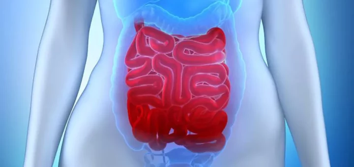 Dificultad diagnostica en hemorragias de intestino delgado