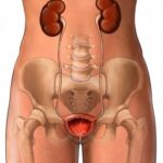 ¿Cuáles son las vías urinarias bajas?