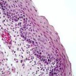 La coloración con hematoxilina y eosina