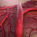 Importancia de la patología vascular