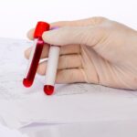 Valor del hematocrito normal en adultos
