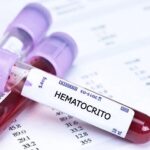 Valores bajos del hematocrito