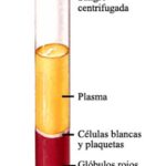 Capa tromboleucocítica