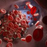 Causas de trombocitopenia