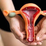 Características del cuello uterino