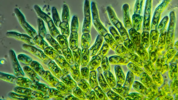 Importancia de la clorofila en las algas