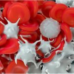 ¿Qué es la trombocitosis esencial?