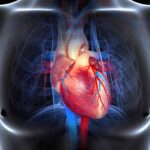 Miocardiopatía como causa de insuficiencia cardiaca
