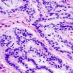 ¿Cuál es el corte de rutina en histología?