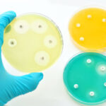 Cuantificación de la susceptibilidad bacteriana a un antibiótico