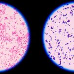 Primer paso para identificación de una bacteria
