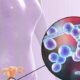 Manifestaciones clínicas de la candidiasis vaginal