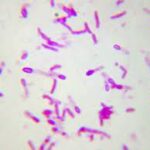 Bacilos grampositivos formadores de esporas