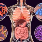 Relación de los microbios con enfermedades no infecciosas