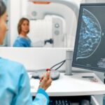 Papel de las imágenes en la detección de tumores mamarios