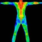 Pérdida de calor corporal