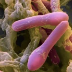 ¿Desde cuando se conoce el botulismo?