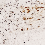 ¿Qué son los osmorreceptores?