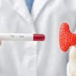 Utilidad de las pruebas tiroideas sistemáticas