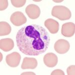 Anaplasmosis granulocitotrópica de seres humanos