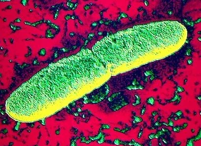 Yersinia pestis, agente causal de la peste