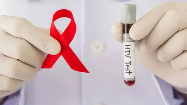 Detección sistemática de la infección por el VIH