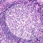 Organización del tejido linfático