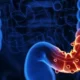 Hemorragia diverticular, alternativas de manejo