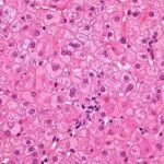 Hepatocitos, las células especializadas del hígado.