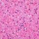 Hepatocitos, las células especializadas del hígado.